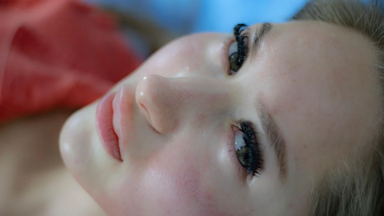 ¿la alimentación realmente influye en el acné?